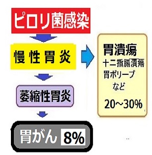 ピロリ菌検査よくある質問 郵送検査キットセンター